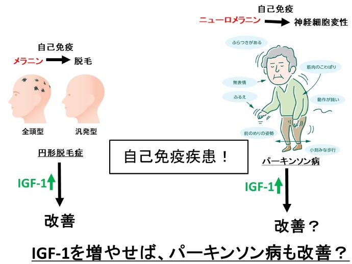 円形脱毛症　病院